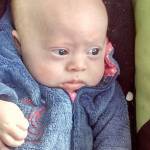 Bimbo con sindrome Down genitori vogliono abortire12