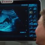 Bridget Jones's baby: nuovo amore e figlio in arrivo, il trailer5