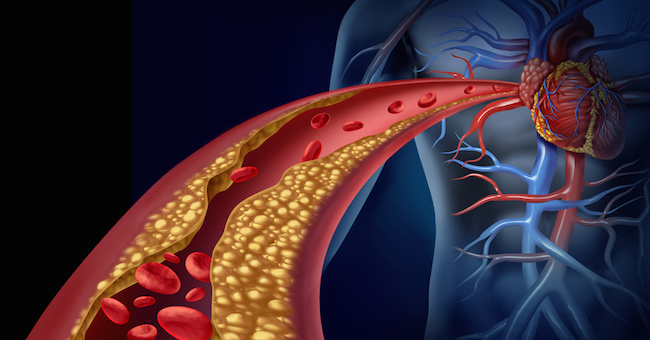 Colesterolo, 10 cose da sapere per proteggere il cuore