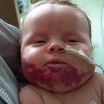 Voglia non lo fa respirare: neonato salvo con farmaco pressione alta 3