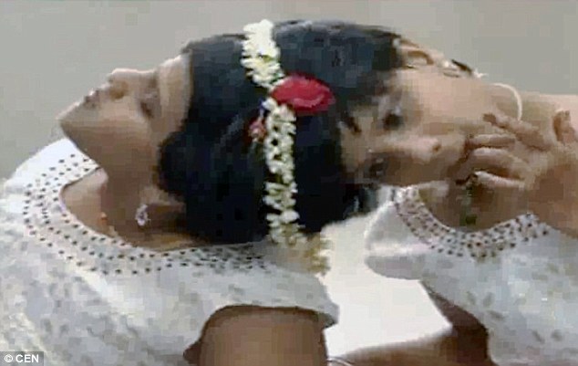 India, gemelle siamesi adottate da ospedale festeggiano 14 anni2