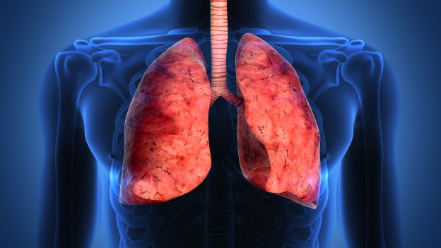 Tumore ai polmoni, nuove speranze dalla immunoterapia