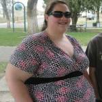 Celia perde 100 chili: ora ha 9 chili di pelle in eccesso9