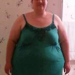 Celia perde 100 chili: ora ha 9 chili di pelle in eccesso8