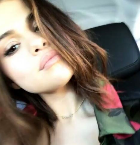 Selena Gomez rifatta? Cosa è successo al suo viso VIDEO