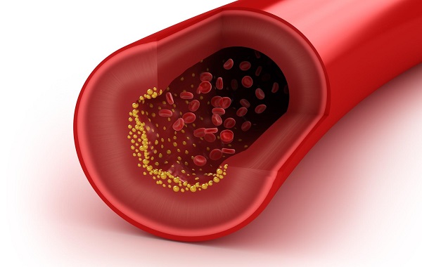 Colesterolo alto, come prevenirlo: i cibi amici del cuore