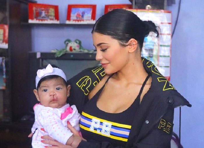 Kylie Jenner dona 1 mln di $ a bimbi col labbro leporino VIDEO
