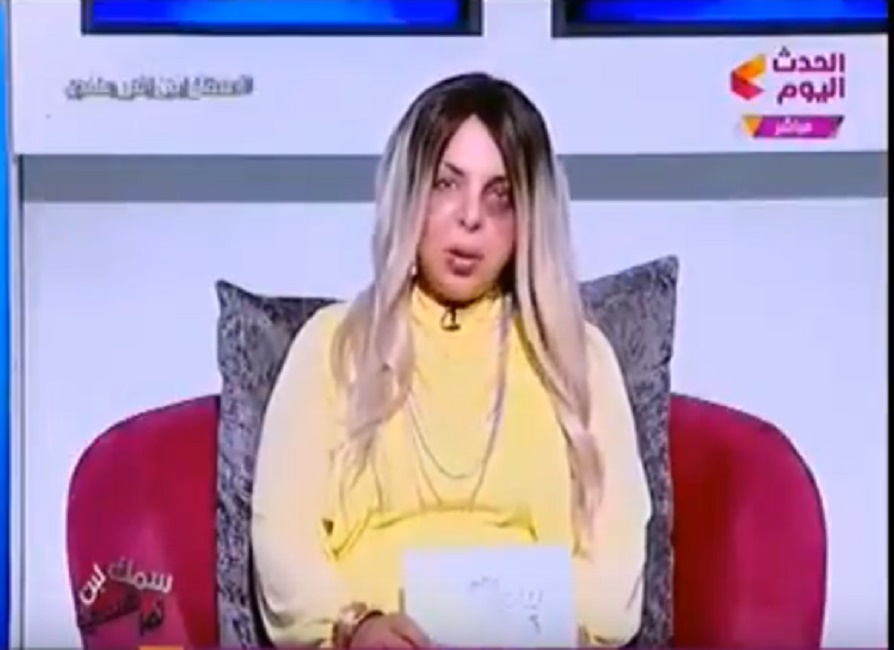 Giornalista egiziana maltrattata dal marito: la verità dietro al