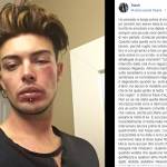 Stash difende una donna e viene picchiato: la denuncia in una FOTO su Facebook