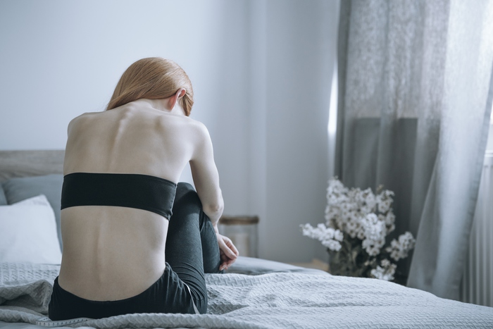 Anoressia e bulimia, 3000 decessi tra giovani nel 2016: anche social colpevoli