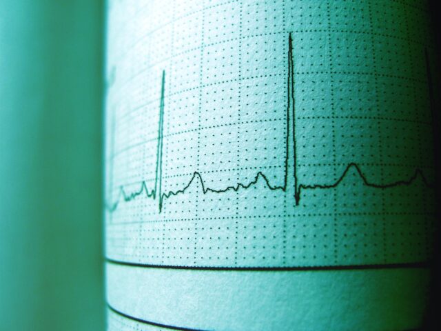 Covid-19: ancora rischio cardiovascolare a 3 mesi dalla guarigione