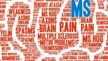 L'impatto sociale ed economico della sclerosi multipla sui pazienti